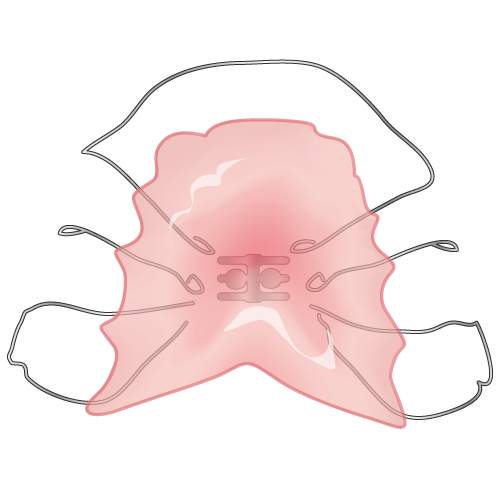 床矯正のイメージ画像