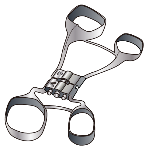 小児矯正で使用する急拡大装置のイラスト