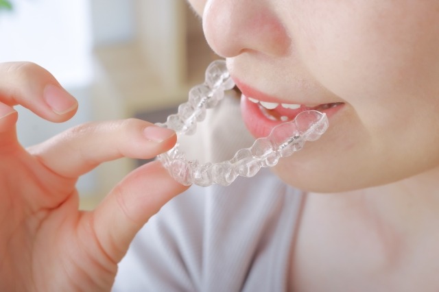 マウスピース型矯正装置の画像