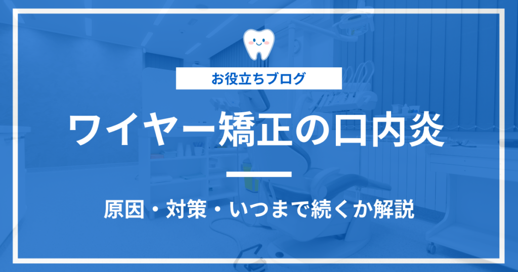 ワイヤー矯正の口内炎に関する記事のアイキャッチ画像