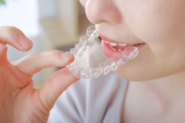 目立ちにくいマウスピース矯正型装置を装着する画像