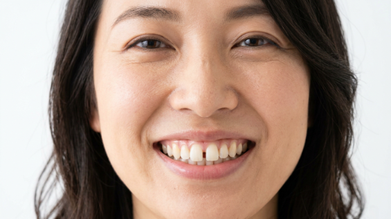 前歯の歯並びがすきっ歯になっている女性