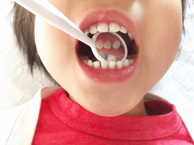 子どもの口の中をミラーで確認する画像